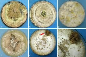 A Polyphasic Taxonomy Of Daldinia Xylariaceae Abstract Europe Pmc