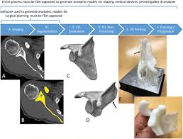 Human bone 3d model 3ds max community, 3ds max downloads, 3ds max resources, 3ds max users, 3dsmax community, 3dsmax resources. Measuring And Establishing The Accuracy And Reproducibility Of 3d Printed Medical Models Radiographics