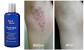 Tend Skin Before And After Legs