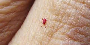 These natural mite predators will work to remove the pests and prevent them from destroying your garden. What Do Chigger Bites Look Like How To Get Rid Of Berry Bugs