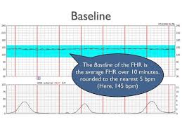 Image result for FHR Variability