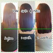 How do residential and outpatient rehab programs compare. Hsn Results After Just 2 Months Hair Skin Hair Skin Nails Skin