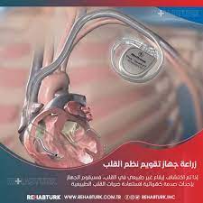 يمكنك استخدام أجهزة الكمبيوتر والهواتف المحمولة ومجففات الشعر والأجهزة الكهربائية وأجهزة الراديو وأجهزة التلفزيون والستيريو والبطانيات الكهربائية والمكانس الكهربائية والسخانات الكهربائية. ØªØ±ÙƒÙŠØ¨ Ø¬Ù‡Ø§Ø² ØªÙ†Ø¸ÙŠÙ… Ø¶Ø±Ø¨Ø§Øª Ø§Ù„Ù‚Ù„Ø¨ Ø§Ù„Ø¯Ø§Ø¦Ù… ÙÙŠ ØªØ±ÙƒÙŠØ§ Ø´Ø¨ÙƒØ© Ø±ÙŠÙ‡Ø§Ø¨ØªÙˆØ±Ùƒ Ù„Ù„Ø¹Ù„Ø§Ø¬ ÙÙŠ ØªØ±ÙƒÙŠØ§