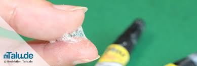 In seltenen fällen kann diese art von klebstoff auch verbrennungen verursachen. Sekundenkleber Von Kleidung Und Haut Entfernen So Geht S Talu De