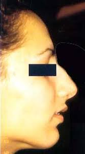 Virtual Journal of Orthodontics