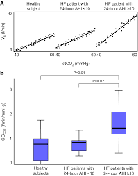 Image result for Cheyne-Stokes Respiration