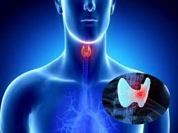 Các trường hợp không có thành phần di truyền được cho là lẻ tẻ. Calcitonin Dáº¥u áº¥n Cá»§a Ung ThÆ° Tuyáº¿n Giap Thá»ƒ Tá»§y Medlatec