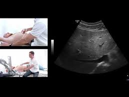 How To Ultrasound The Liver Youtube