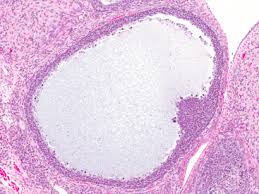 Follicles consisting of an oocyte surrounded by layers of follicle cells develop in the cortex of the ovary. Follicular Atresia An Overview Sciencedirect Topics