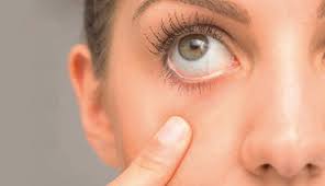 Yeux qui brulent le soir. Affections Oculaires Vous Avez La Larme A L Oeil Dynaphar Be