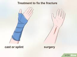 Image result for Hand Growth Plates