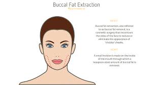 What should i expect during a consultation for buccal fat removal? Buccal Fat Extraction Qunomedical