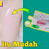 Kulit muka kering serta jerawat dan jeragat menjadikan kulit anda kusam tanpa seri. 1