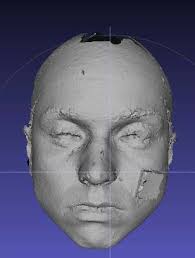 Technology Project: Shape-Based Retrieval of 3D Craniofacial Data