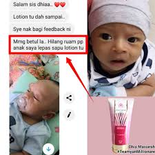 Berikut adalah jenis vitamin untuk kulit yang harus anda penuhi setiap hari. Nurizwani Nurizwaniramli Twitter