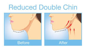 Fix Your Double Chin With These Effective Exercises Reduce Double Chin Double Chin Exercises Chin Exercises