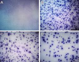 What does a positive tuberculosis test look like. T Spot Tb Test Performance Results On Pleural Effusions A Nil Download Scientific Diagram