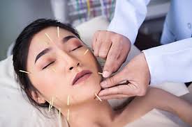 Cosmetic Acupuncture