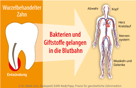 Hirntodwann ist ein mensch tot? Wurzelkanalbehandlung Dr Med Edith Nadj Papp Ditzingen Sachsenheim