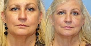 Brian Windle Plastic Surgery (closed)