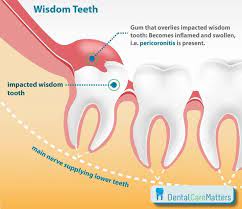 Pin On Oral Health