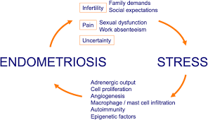 Is Stress A Cause Or A Consequence Of Endometriosis Springerlink