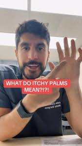 What do itchy palms mean?!, #dermatology #dermatologist