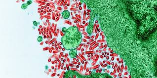 Image result for Rabies