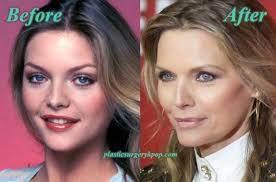 · she sticks to clean . Michelle Pfeiffer Nose Job Plastic Surgery Before And After Pictures