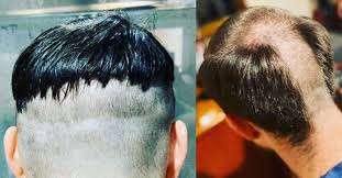 Le 1er mars dernier, le chanteur de 30 ans a répondu avec humour à un message posté sur twitter par un internaute et dans lequel ce dernier s'est moqué de sa coupe de. Heureusement On Est Confines Ils Tentent La Coupe De Cheveux Maison Et C Est Drole 11