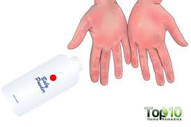 How To Stop Sweaty Hands Top 10 Home Remedies Sweaty Hands Stop Sweaty Hands Home Remedies
