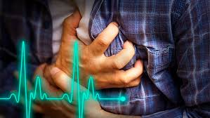 Can coughing stop a heart attack? - UChicago Medicine