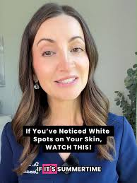 If you’re seeing lighter spots