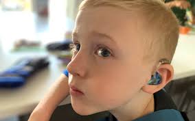 Backed by a team of hearing loss experts, 7-year-old Rory is reaching his  full potential