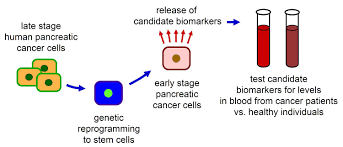 The uk's national health service (nhs) is to pilot a simple blood test that may detect more than 50 types of cancer and, it is hoped, could help thousands of people by allowing the disease to be treated more successfully at an earlier stage. Blood Test For Early Detection Of Pancreatic Cancer Headed To Clinic