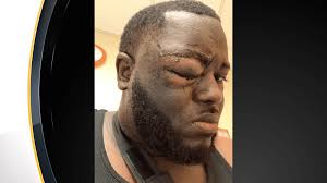 Defense Attorney: Aaron Donald Broke Up Fight, Didn't Start It