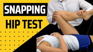 Image result for Snapping Hip