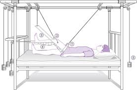 Hip traction technique for jammed hips. Traction Nurse Key