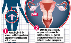 Some breast cancer treatments can bring on menopause more abruptly than it would happen otherwise. New Operation Cuts The Risk Of Ovarian Cancer And An Early Menopause Daily Mail Online