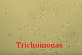 Image result for trichomonas images