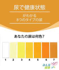 尿で健康状態がわかる 8つのタイプの尿 みんな健康 健康 代替療法 健康のモチベーション