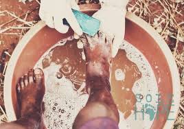 Scariest feet get rid of jiggers parasites eggs cleaning step cleaning boy`s foot from parasitic eggs. Pin On Sole Hope Shoe Cutting Party