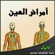 مواضع الحجامة لأمراض العين