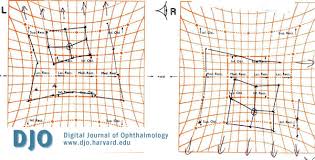 Djo Digital Journal Of Ophthalmology