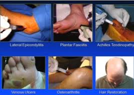 Vreau să devin voluntar ao medlife: Dr Buciu Gabriel Cabinet Ortopedie Si Traumatologie Prp Facebook