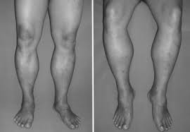 Quad leg muscles anatomy labeled diagram, vector illustration fitness poster. Demonstrates Marked Leg Muscle Hypertrophy Download Scientific Diagram