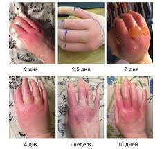 Селективного гербицида на сегодня не существует, однако разработка его ведётся во многих научных центрах. Zametki Fitohimika 2021 Borshevik Habr