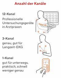 Ein ekg dokumentiert die aktivität des menschlichen herzens. Mobile Ekg Gerate Jederzeit Selbst Den Herzrhythmus Messen