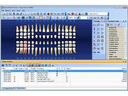 Dentalcompare Product Review Dentrix Is Great