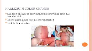 Image result for Harlequin Color Change